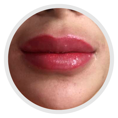 Imagen Micropigmentación Estética